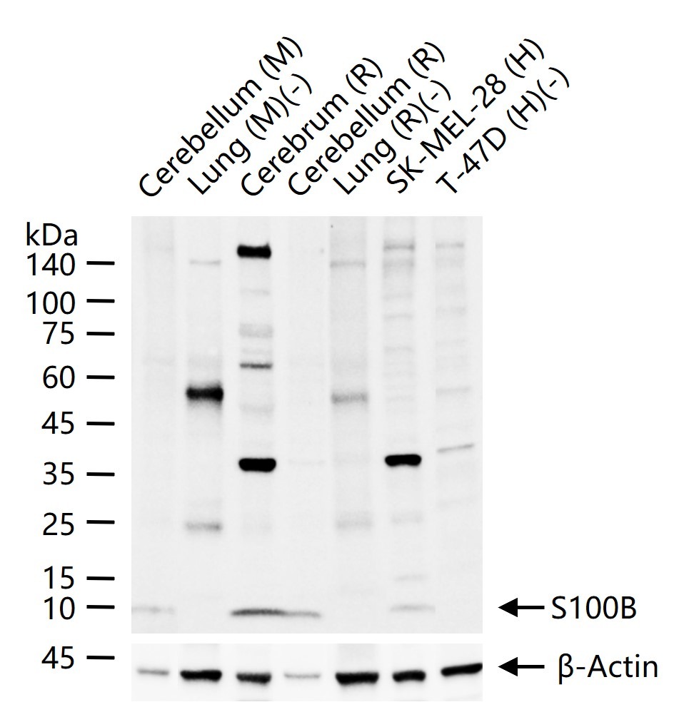 Anti-S100B Antibody (2F740)