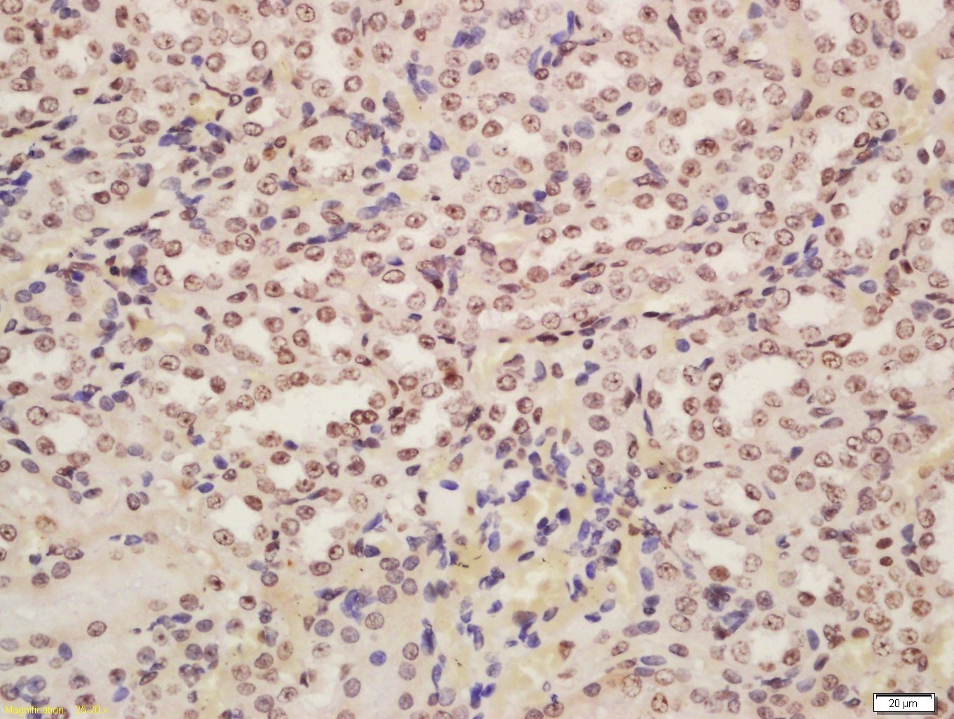 Anti-POD1 Polyclonal Antibody