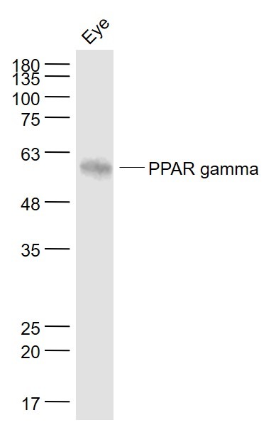 Anti-PPAR gamma/PPARG Antibody (1Z782)