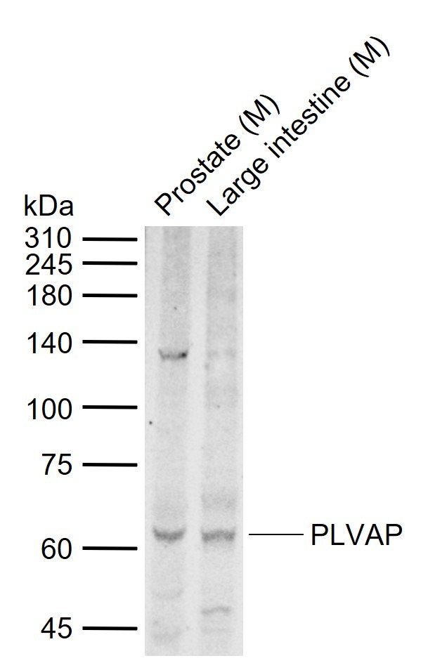 Anti-PLVAP Polyclonal Antibody