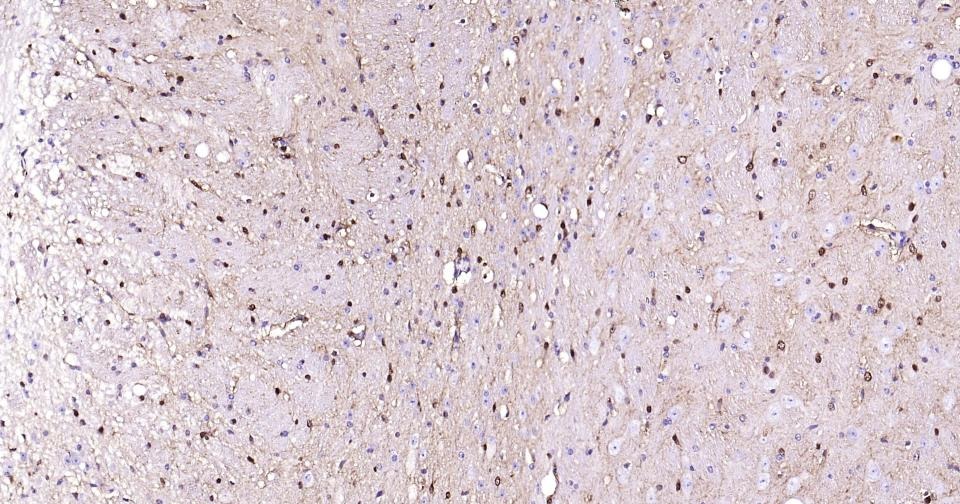 Anti-S100B Antibody (2F740)