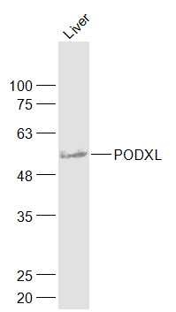 Anti-PODXL Polyclonal Antibody