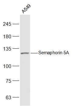 Anti-SEMA5A Polyclonal Antibody