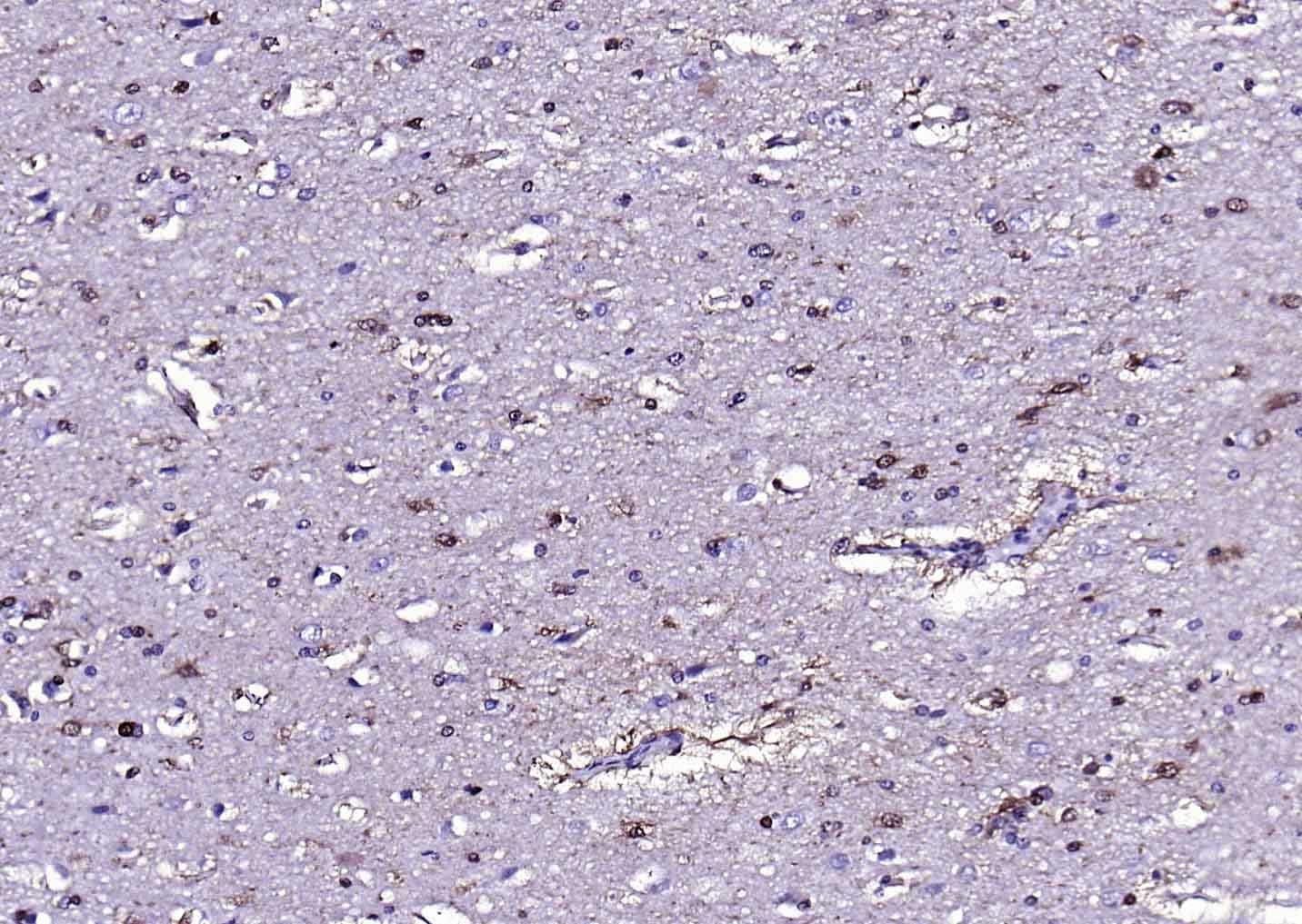 Anti-S100B Polyclonal Antibody