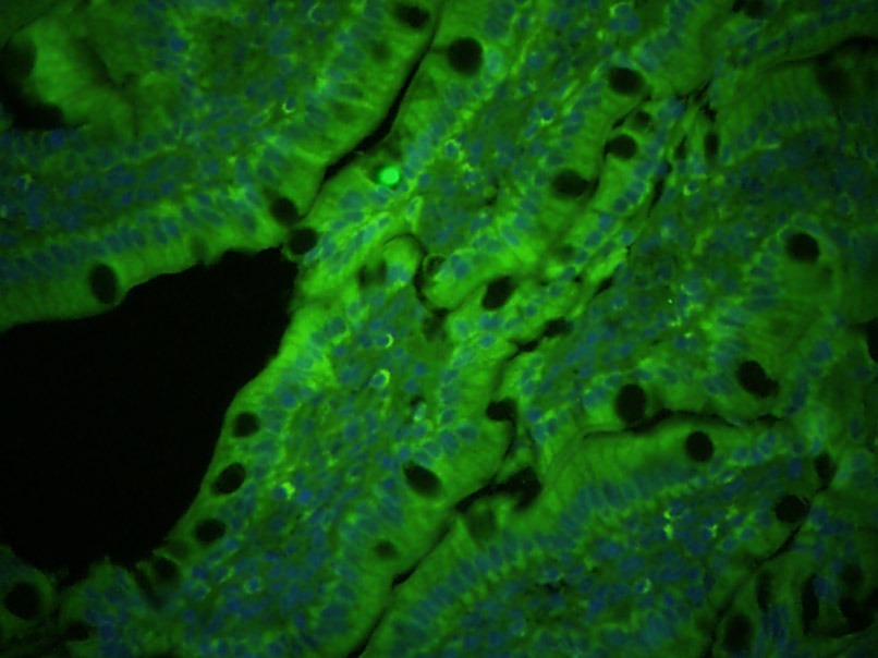 Anti-PLVAP Polyclonal Antibody