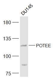 Anti-POTEE Polyclonal Antibody