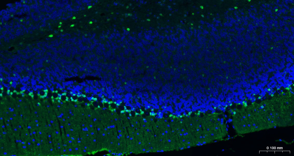 Anti-S100B Antibody (2F740)