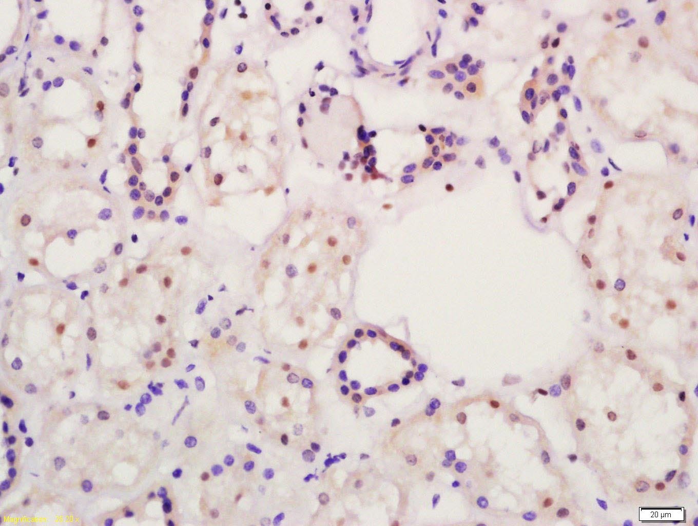Anti-PPAR alpha/PPARA Polyclonal Antibody