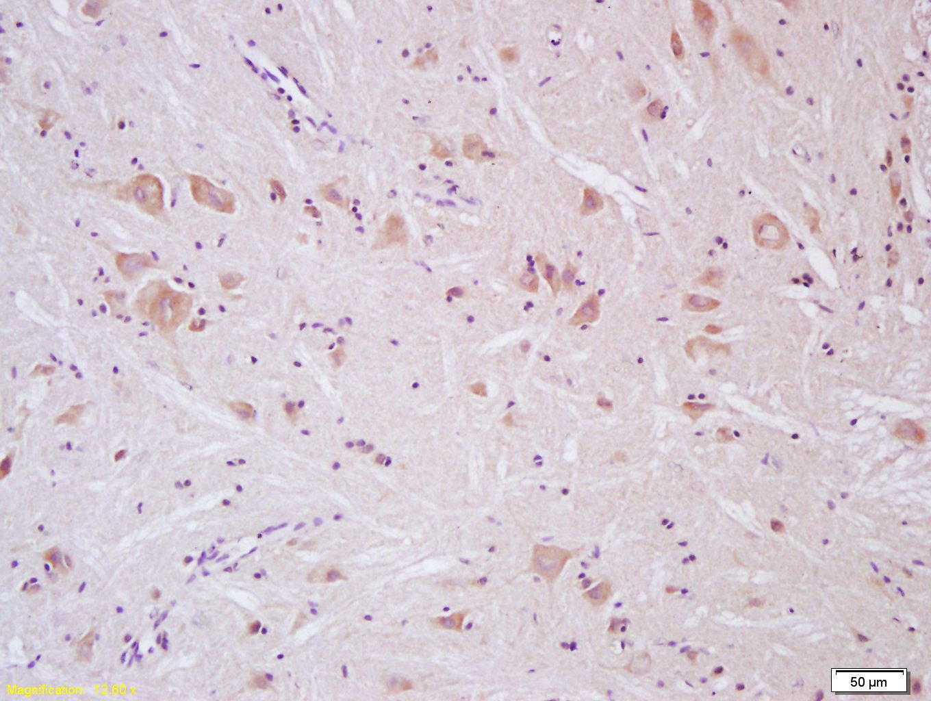 Anti-SCN10A/Nav1.8 Polyclonal Antibody