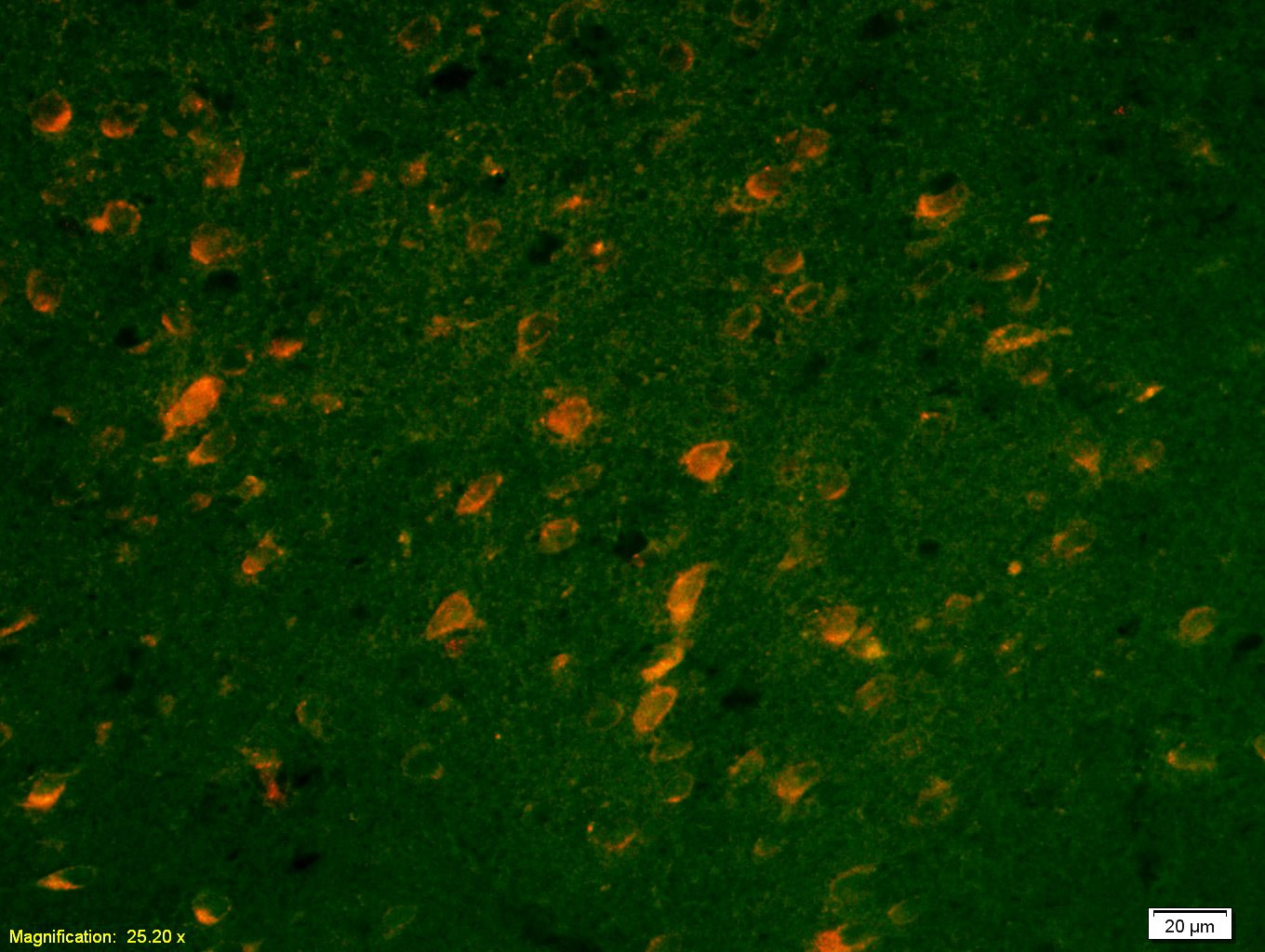 Anti-SCN10A/Nav1.8 Polyclonal Antibody