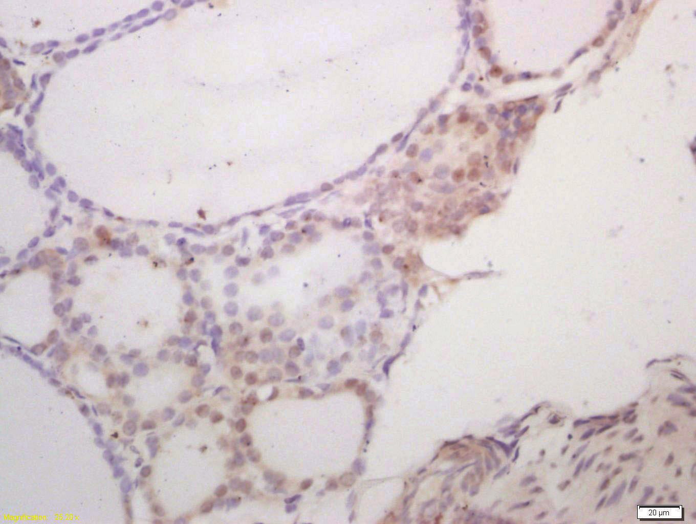 Anti-SCXA Polyclonal Antibody