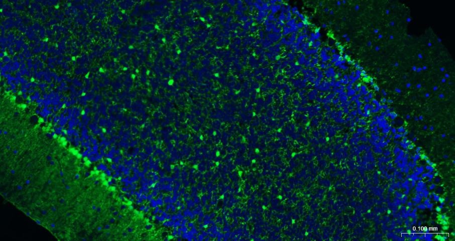 Anti-S100B Antibody (2F740)