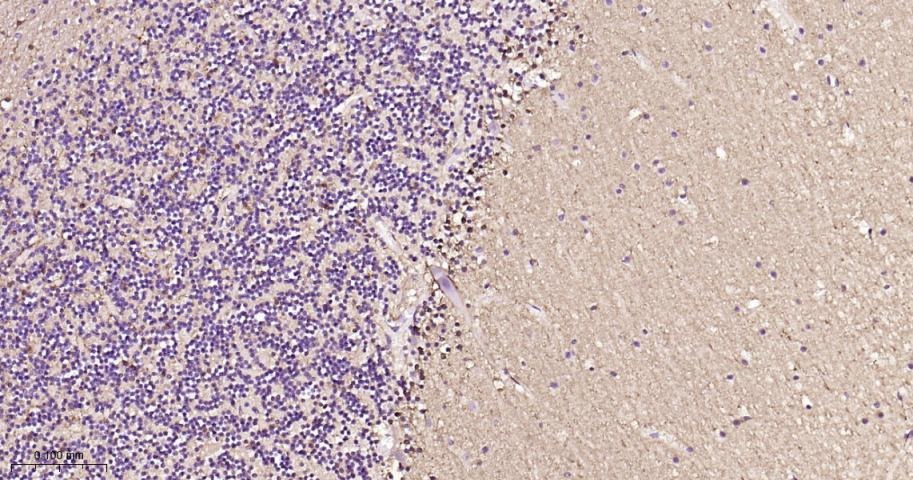 Anti-S100B Antibody (2F740)