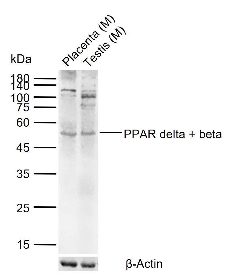 Anti-PPAR delta/beta Polyclonal Antibody