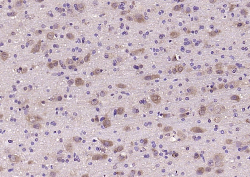 Anti-RAB11A Polyclonal Antibody