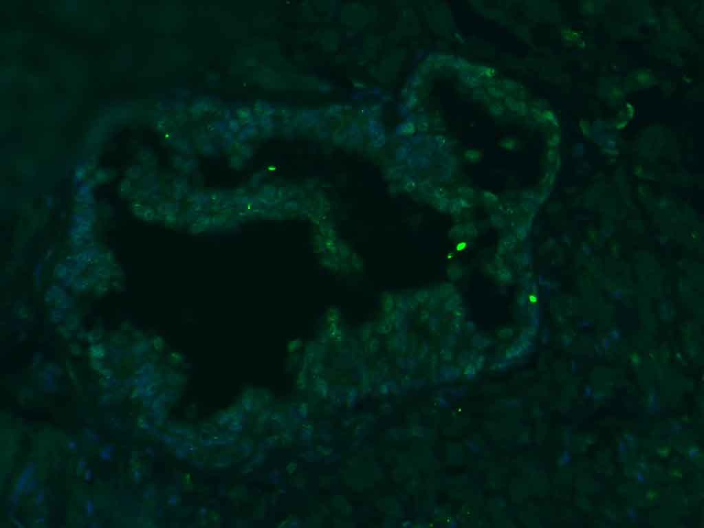 Anti-PLCZ1 Polyclonal Antibody