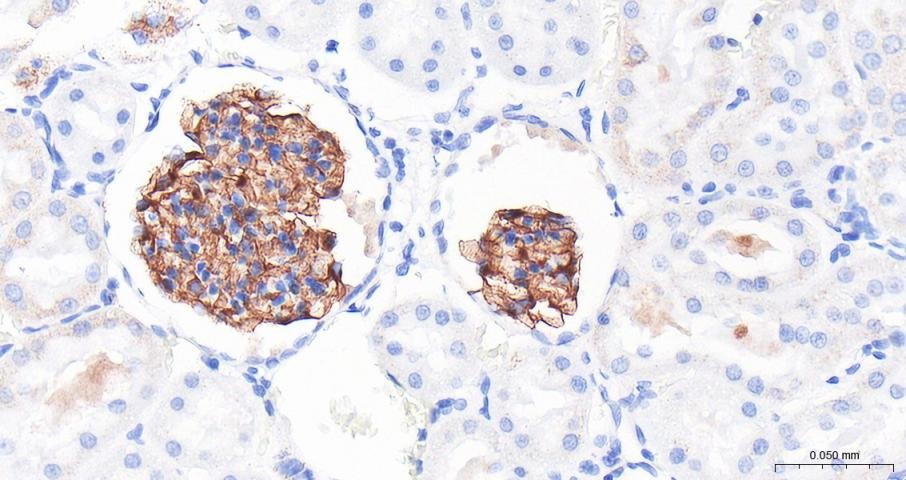 Anti-Podocin Polyclonal Antibody