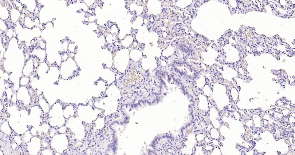 Anti-S100B Antibody (2F740)