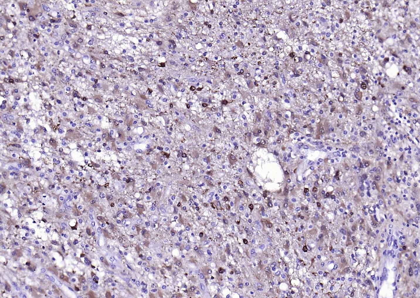 Anti-S100B Polyclonal Antibody