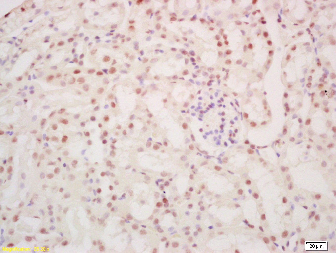 Anti-SALL1 Polyclonal Antibody
