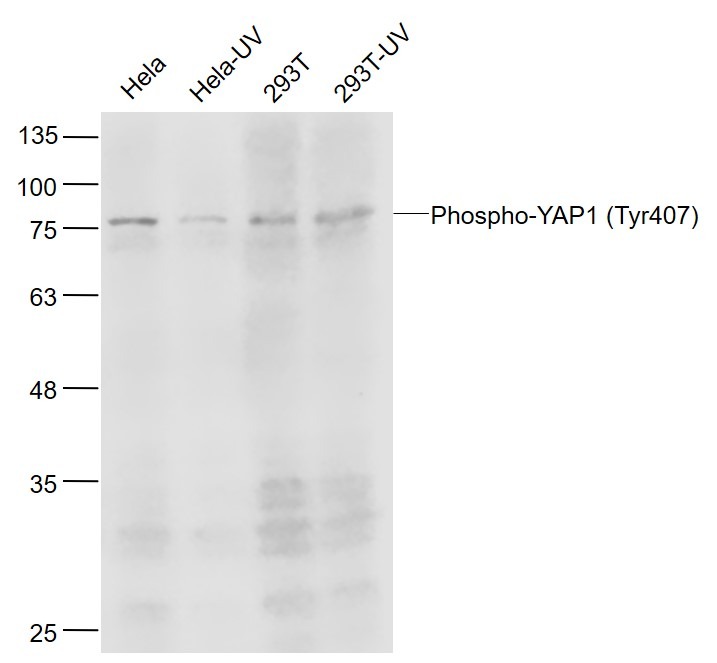 Anti-Phospho-YAP1 (Tyr407) Polyclonal Antibody
