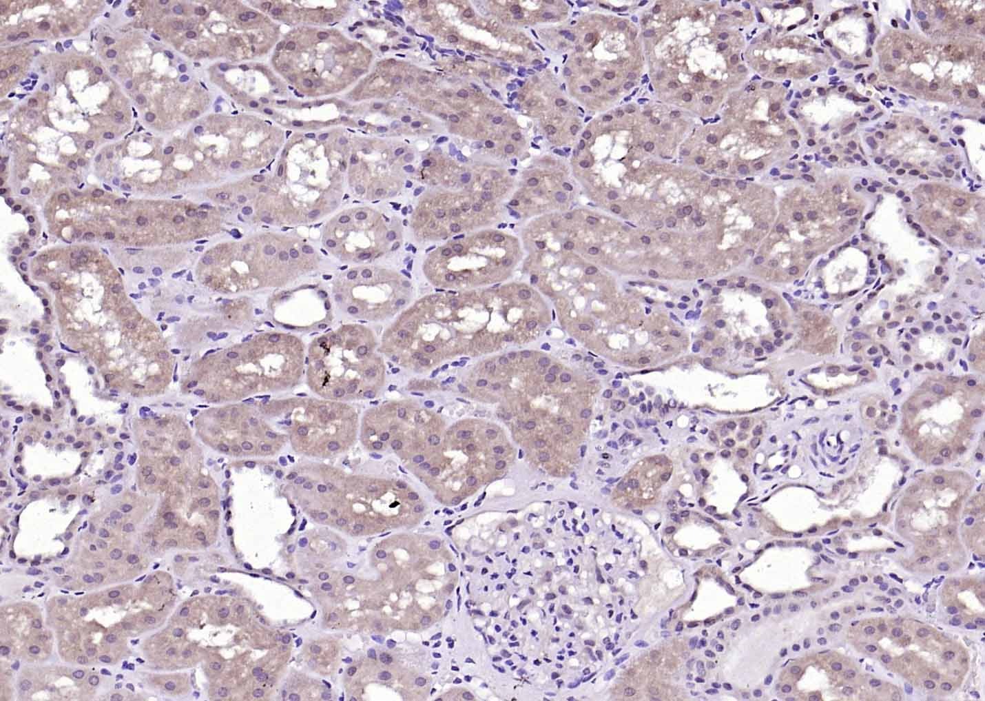 Anti-Phospho-Tyk2 (Tyr1054, 1055) Polyclonal Antibody