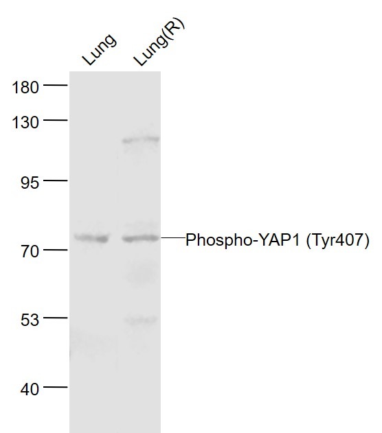 Anti-Phospho-YAP1 (Tyr407) Polyclonal Antibody