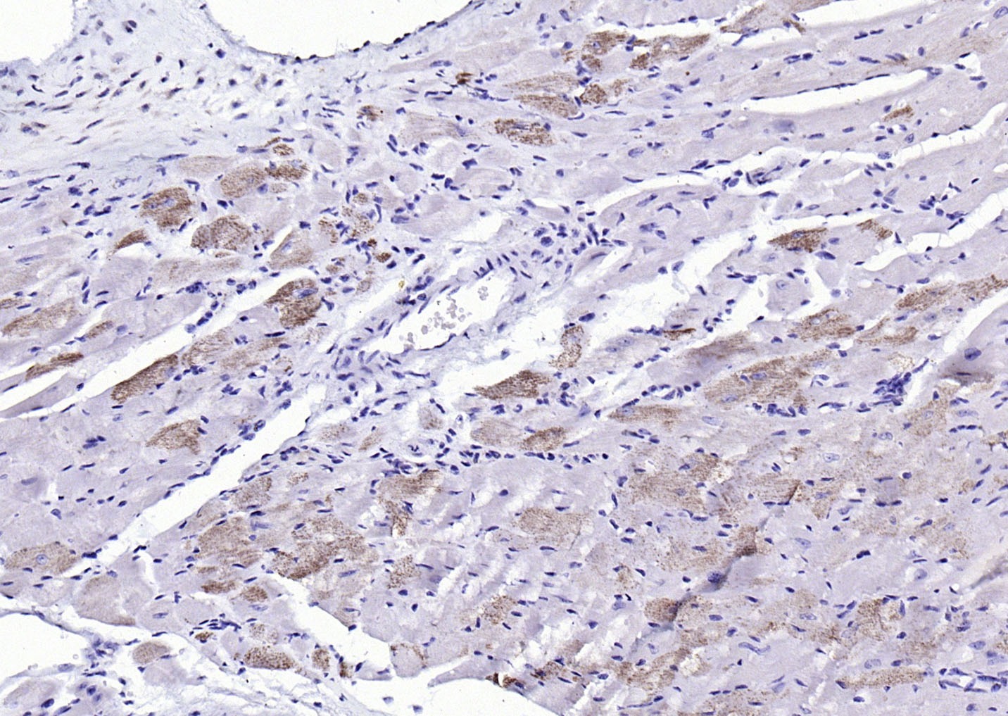 Anti-Sarcomeric Alpha Actinin Polyclonal Antibody
