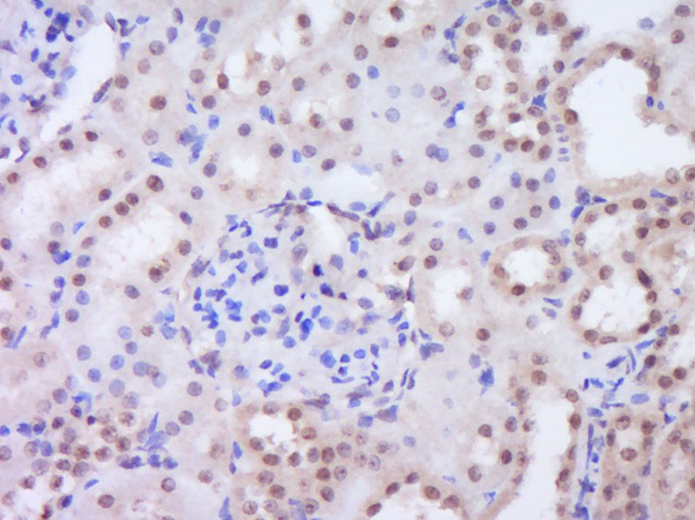 Anti-SALL1 Polyclonal Antibody