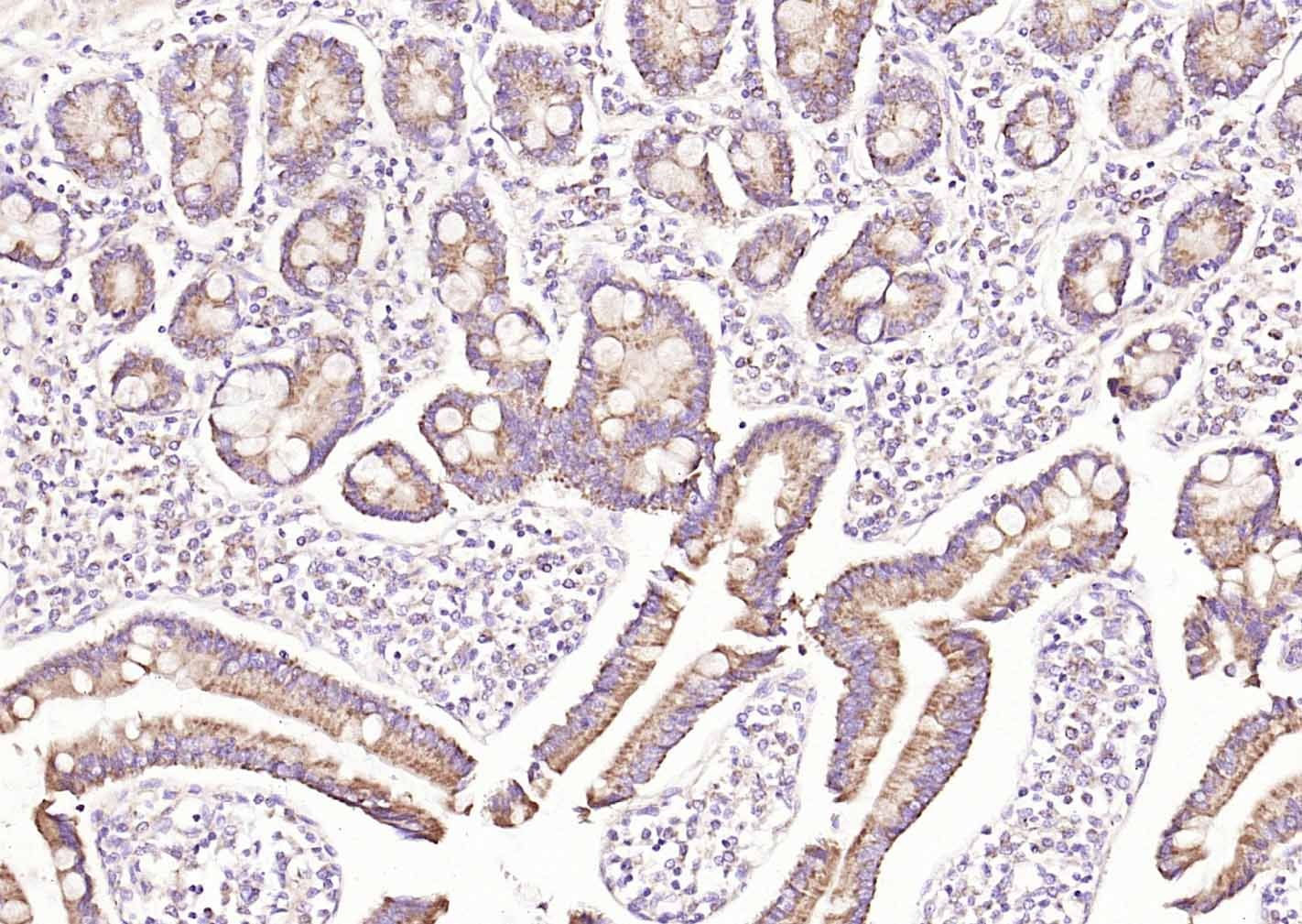 Anti-SAA1 Polyclonal Antibody