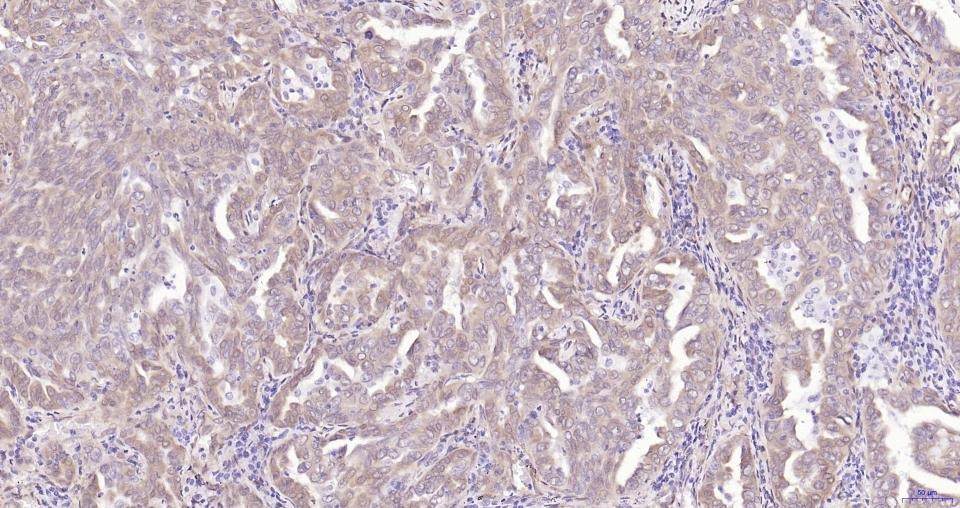 Anti-Phospho-YAP1 (Ser127) Antibody (5B8)