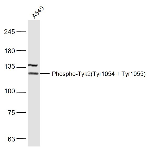 Anti-Phospho-Tyk2 (Tyr1054, 1055) Polyclonal Antibody
