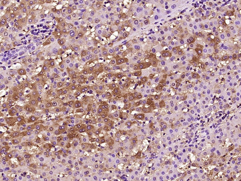 Anti-SAA1 Polyclonal Antibody