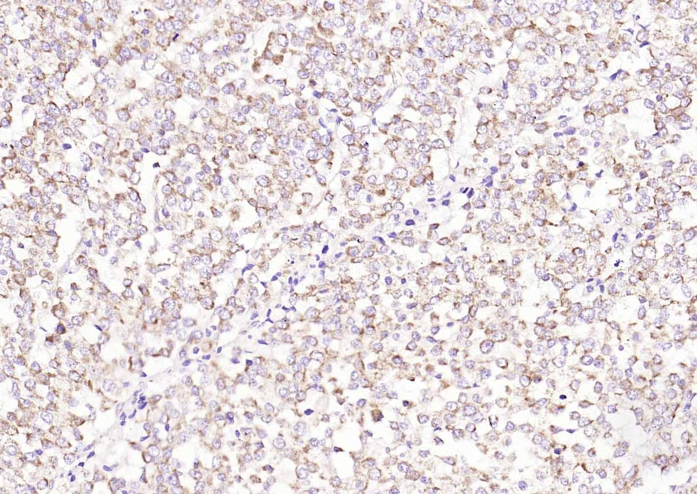 Anti-SAA1 Polyclonal Antibody