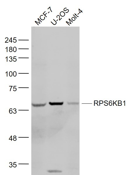 Anti-S6K1/RPS6KB1 Polyclonal Antibody