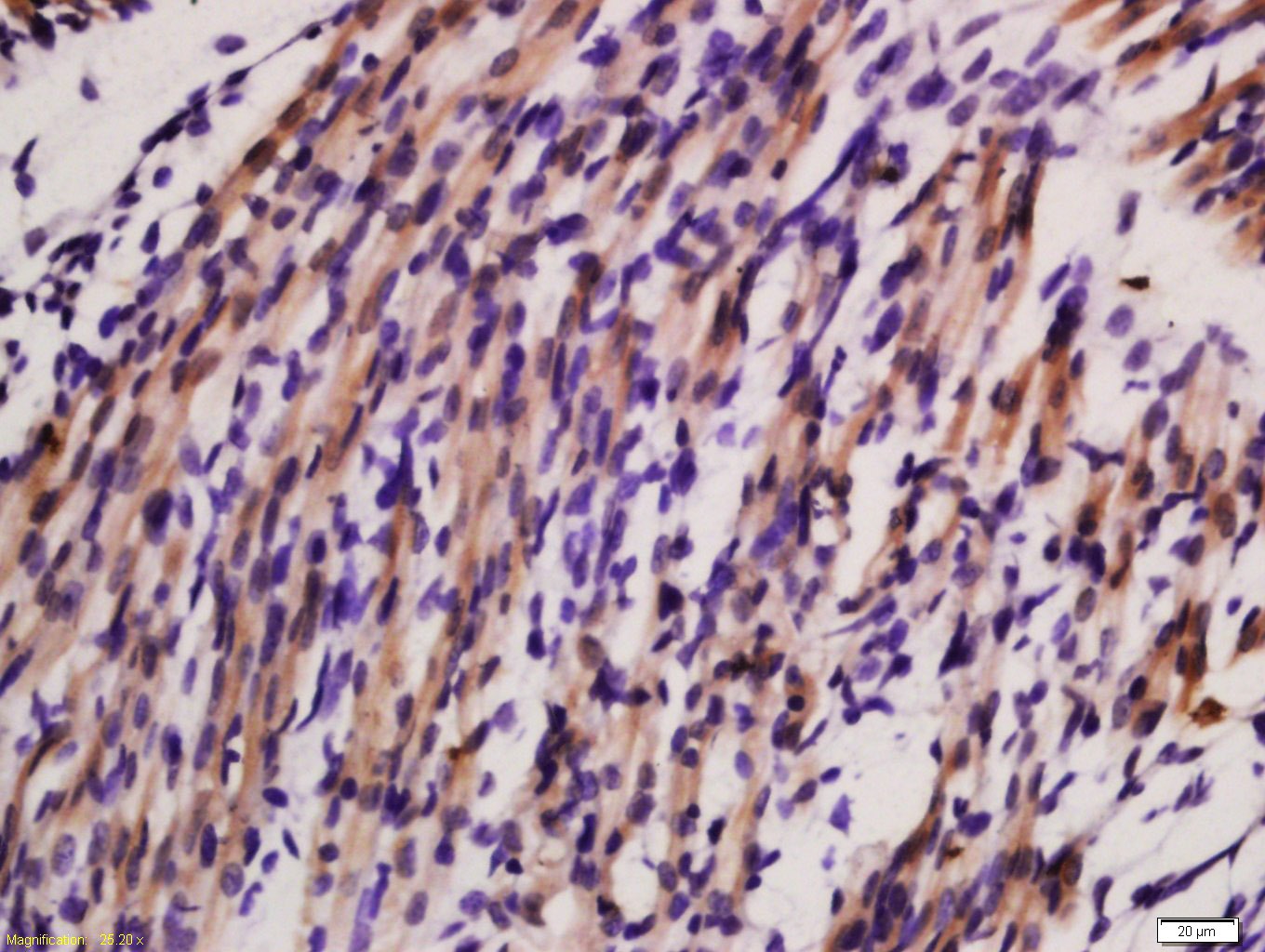 Anti-Sarcomeric Alpha Actinin Polyclonal Antibody