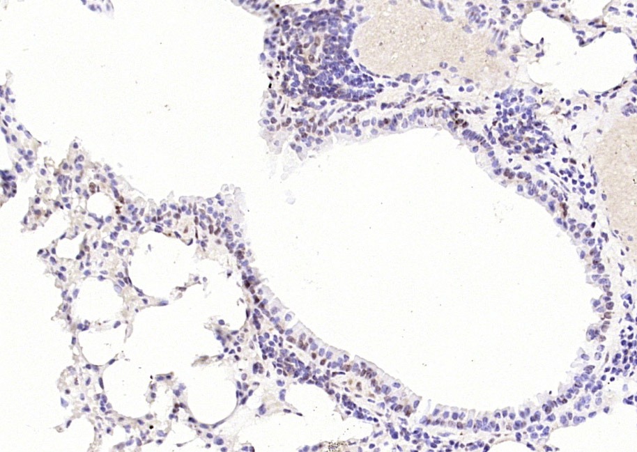 Anti-p53 Polyclonal Antibody 3