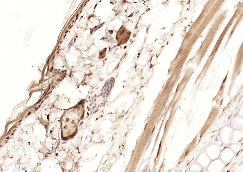 Anti-p53 Polyclonal Antibody 3