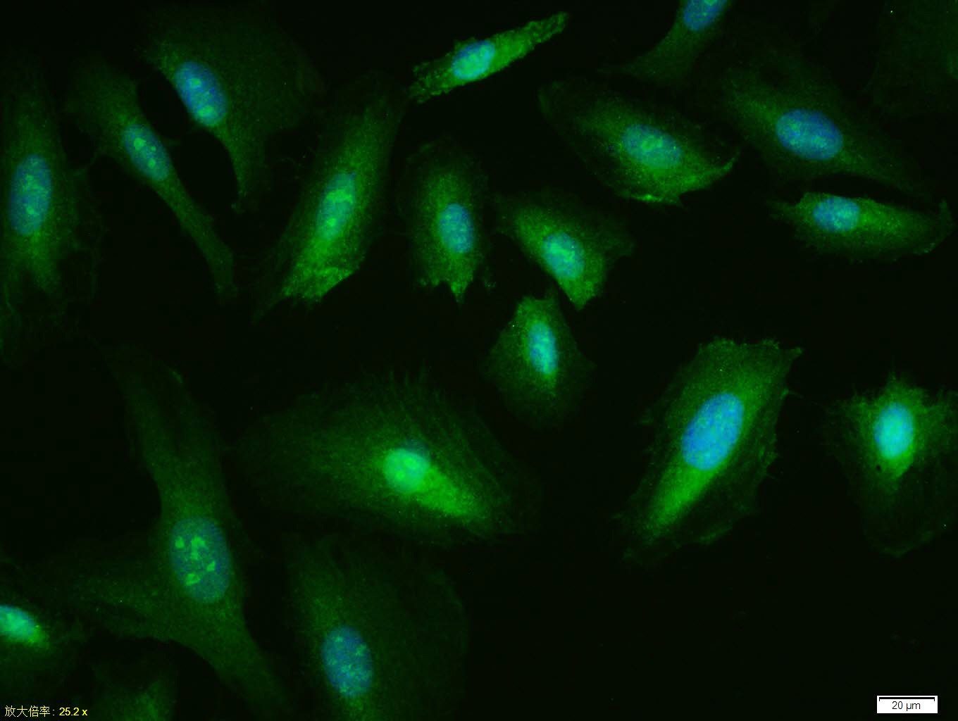 Anti-p53 Polyclonal Antibody 2