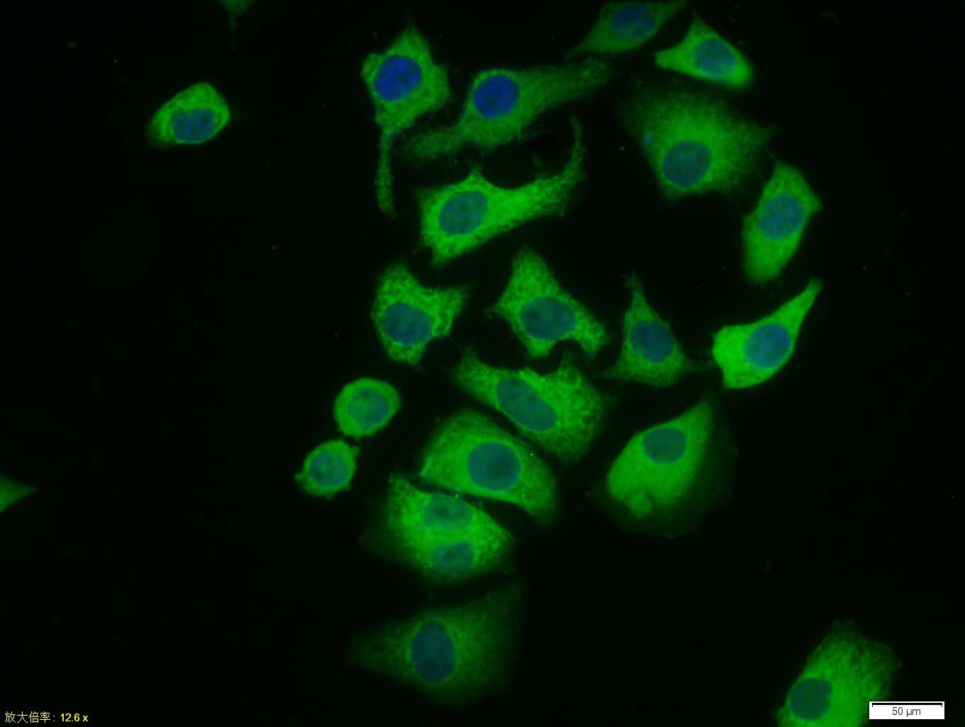 Anti-Phospho-ERK1/2 (Thr183, Tyr185) Polyclonal Antibody