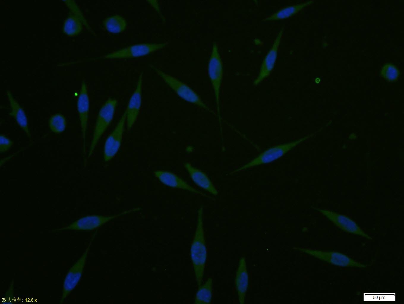 Anti-p53 Polyclonal Antibody 3