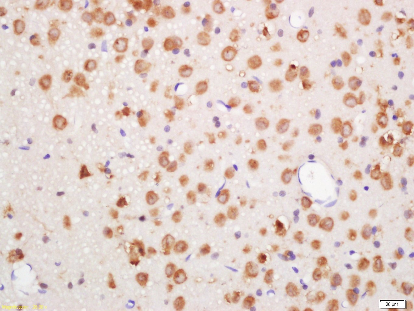 Anti-Phospho-ERK1 (Thr202 , Tyr204) Polyclonal Antibody