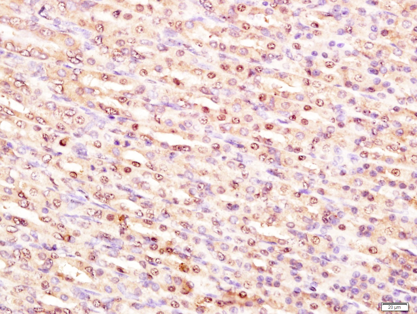Anti-p53 Polyclonal Antibody 3