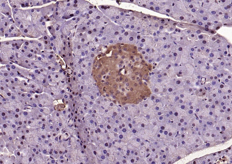 Anti-Phospho-ERK1/2 (Thr202 , Tyr204) Polyclonal Antibody