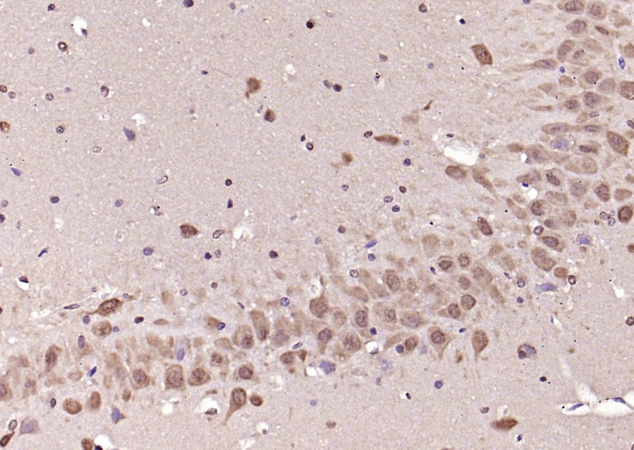 Anti-Phospho-ERK1/2 (Thr202 , Tyr204) Polyclonal Antibody