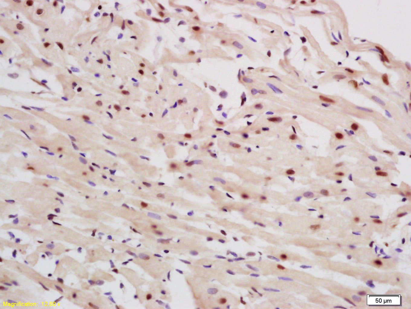 Anti-p63 Polyclonal Antibody