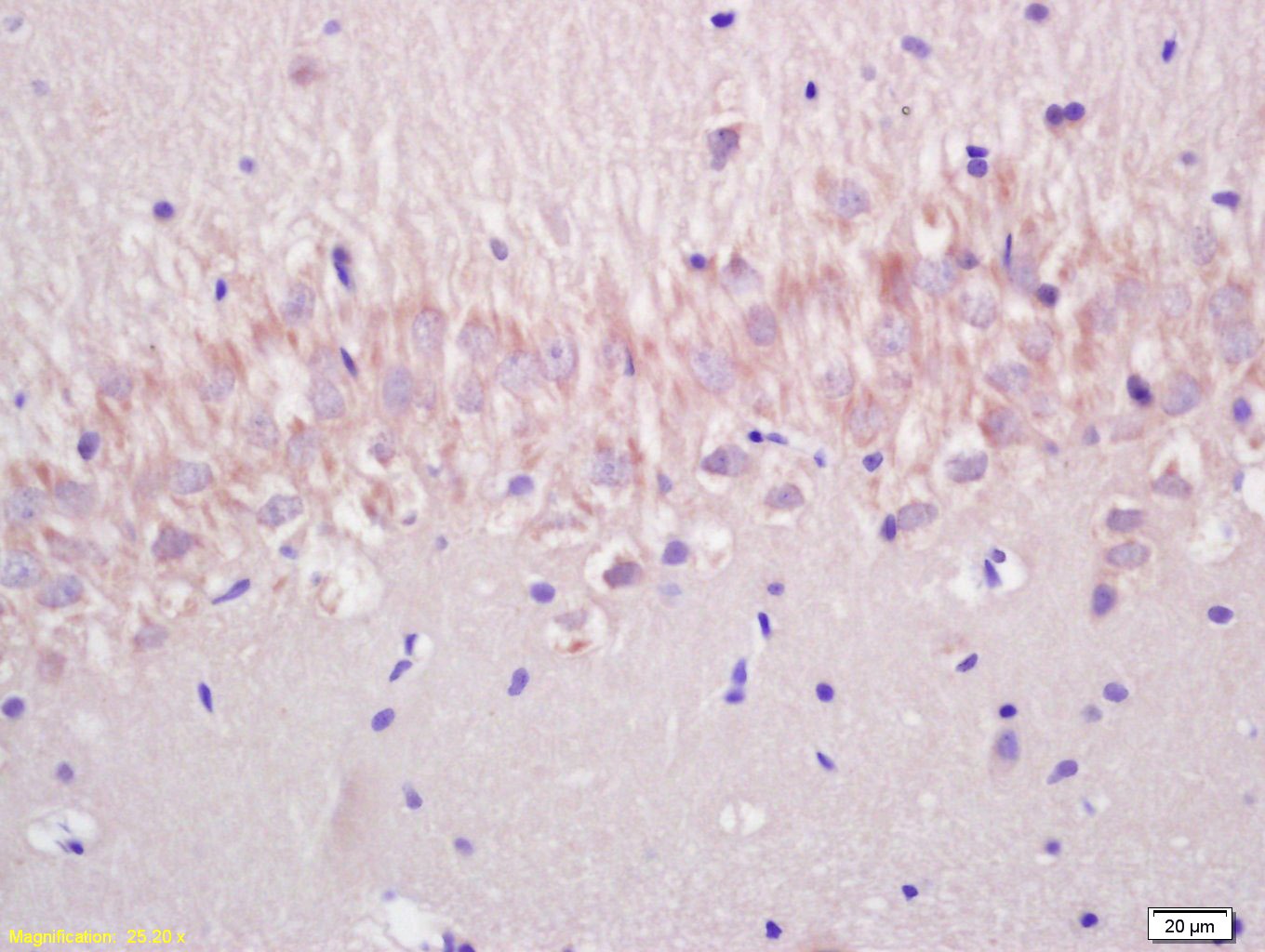 Anti-p53 Polyclonal Antibody 2