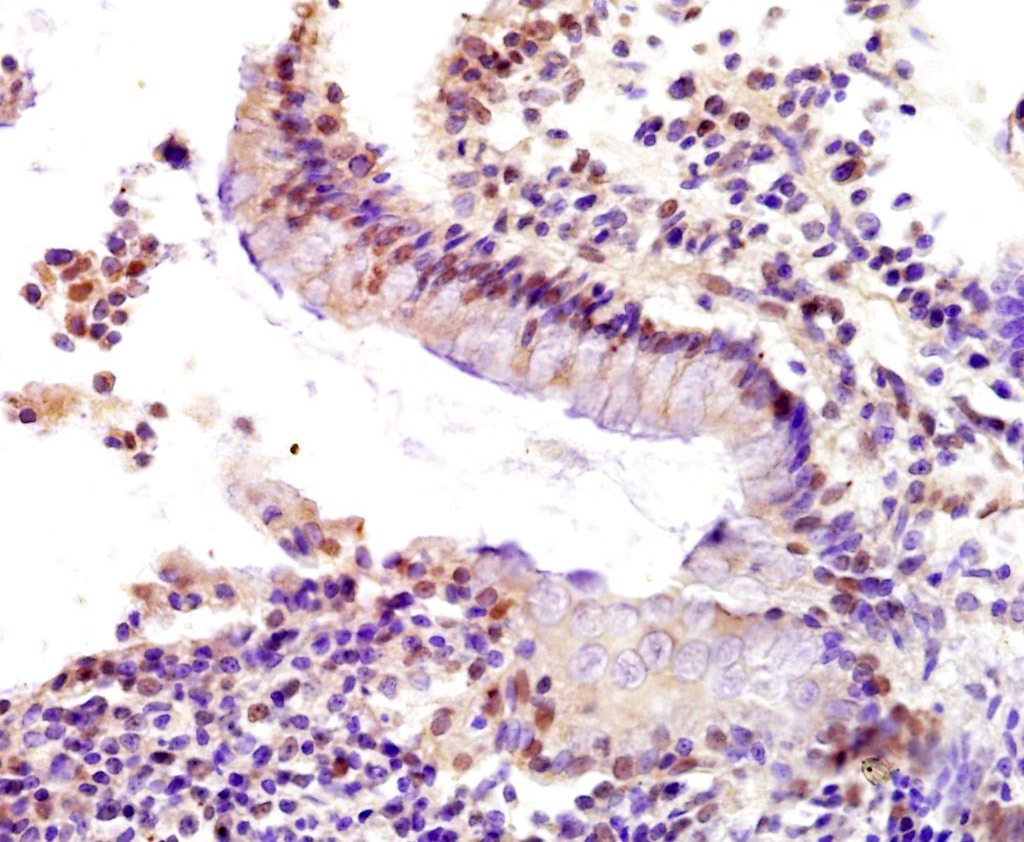 Anti-p53BP1 Polyclonal Antibody