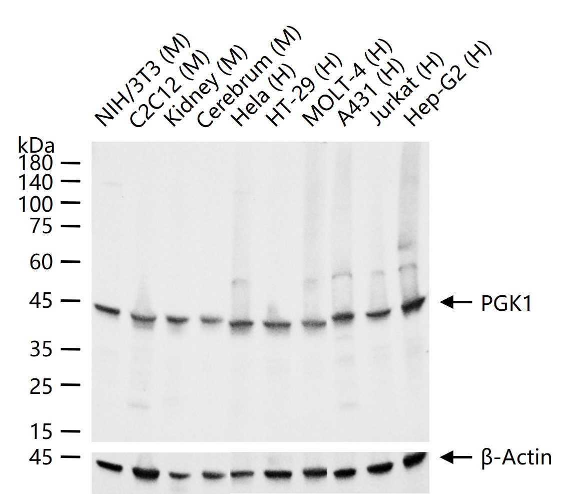 Anti-PGK1 Antibody (2Q169)