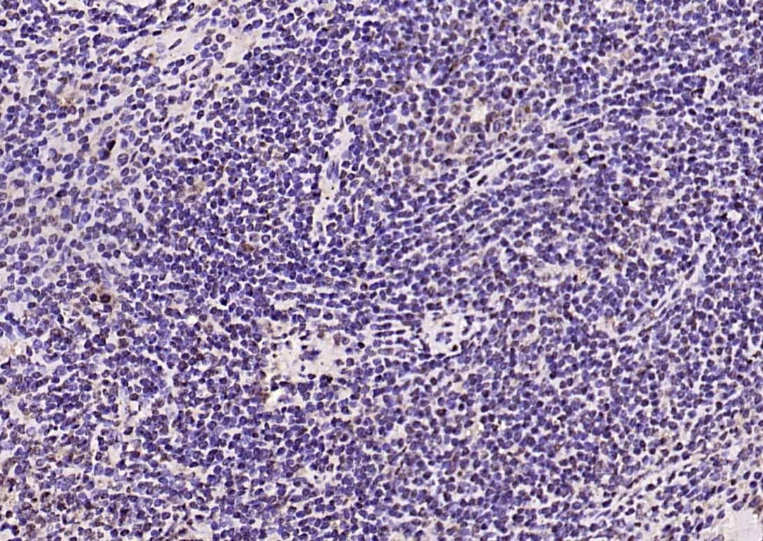 Anti-Phospho-FOXO1 (Ser319) Polyclonal Antibody